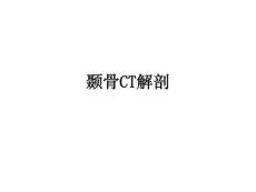 【課件】顳骨CT解剖