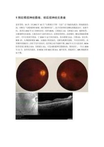 1例右眼視神經(jīng)萎縮、球后視神經(jīng)炎患者