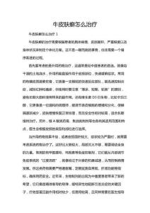 牛皮膚癬怎么治療
