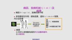 干燥综合征学习教案