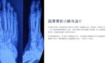 《跖骨骨折诊断与治疗》课件