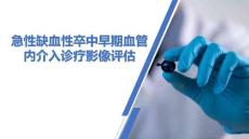 急性缺血性卒中早期血管內(nèi)介入診療影像評估