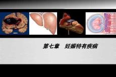 【婦產(chǎn)科學(xué)8版】074妊娠劇吐