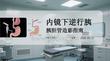 內(nèi)鏡下逆行胰膽管造影指南