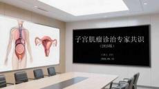 子宮肌瘤診治專家共識（2025版）