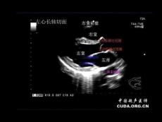 心脏基础超声切面