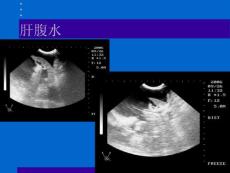 宠物胃肠及小器官超声检查二