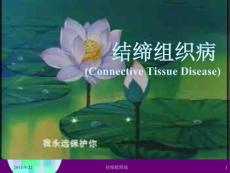 结缔组织病