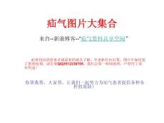 疝气图片大集合