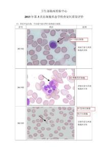 2013年第3次血细胞形态学检查室间质量评价