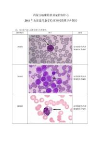 2011年血细胞形态学检查室间质量评价图片
