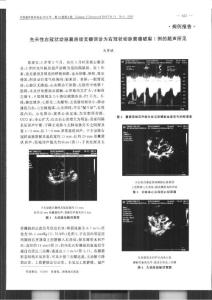 先天性右冠状动脉窦房结支瘘误诊为右冠状动脉窦瘤破裂1例的超声所见