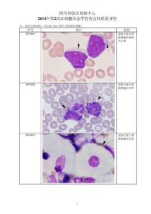 2014年-2014年第二次血细胞形态学检查室间质量评价图片